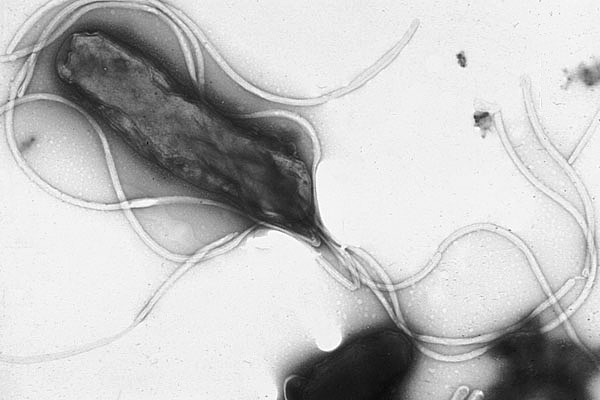 Helicobacter-Infektionen: Symptome und Erfahrungen

